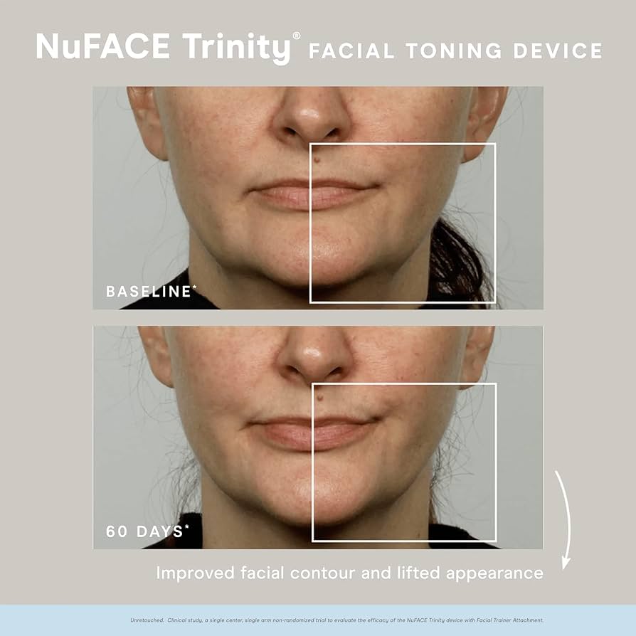 Tonificador facial NuFACE Trinity: resultados visibles en minutos