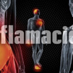 Tratamientos para la inflamación: prevención y reducción